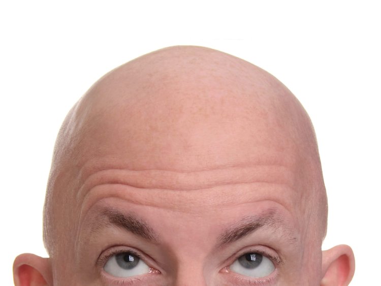 Head of a bald man