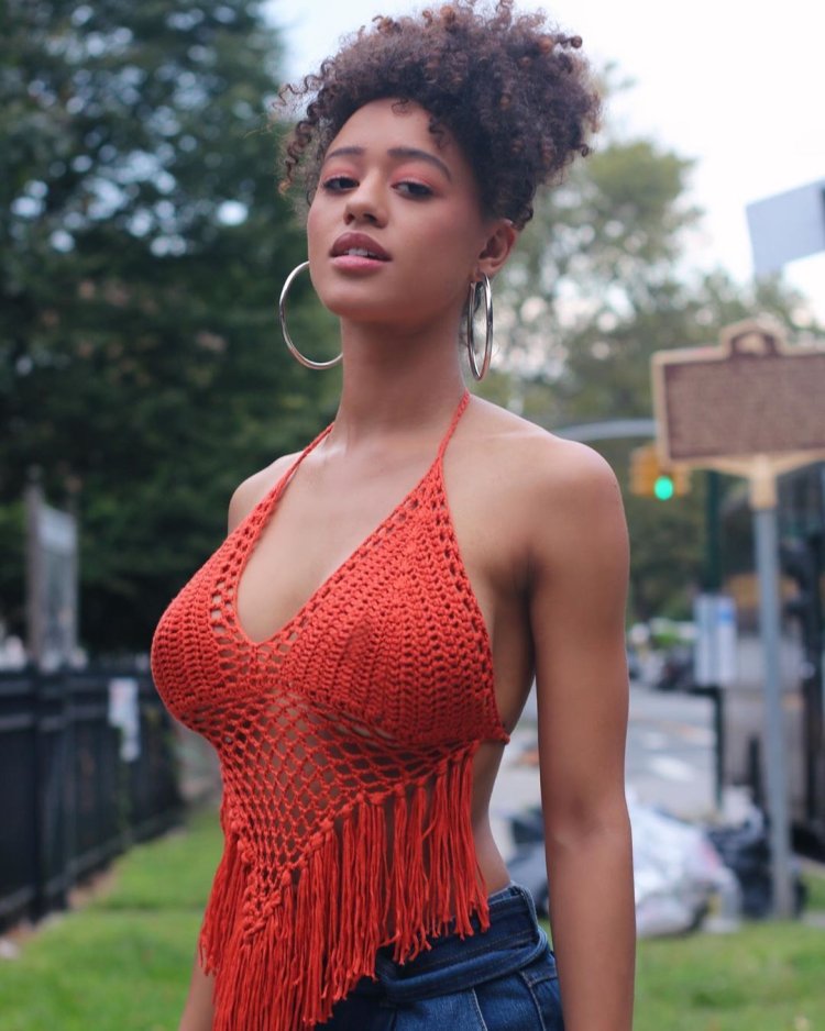 Macromastia gigantomastia