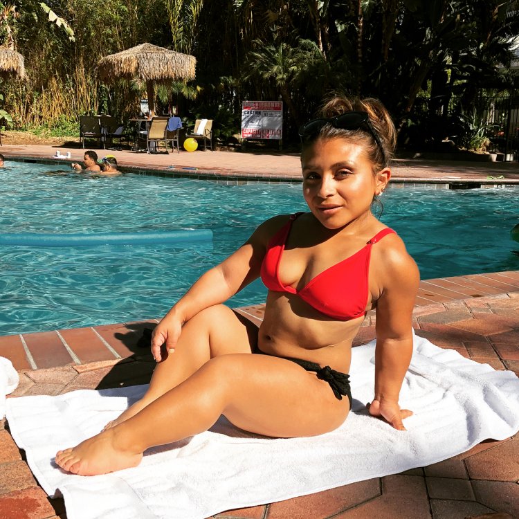 Dwarf model Drew Prest