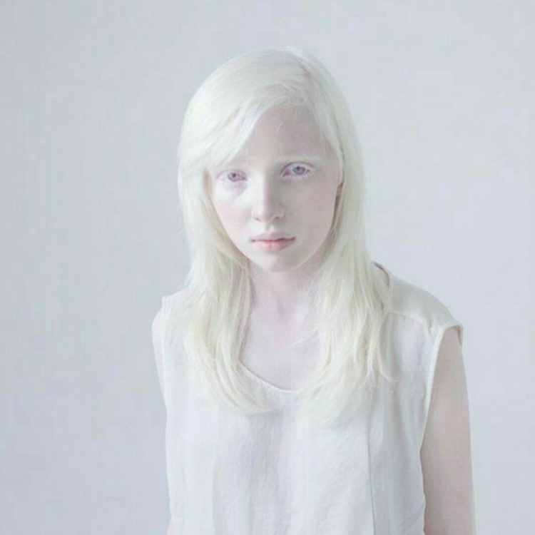 Katerina Tymoshenko Albino