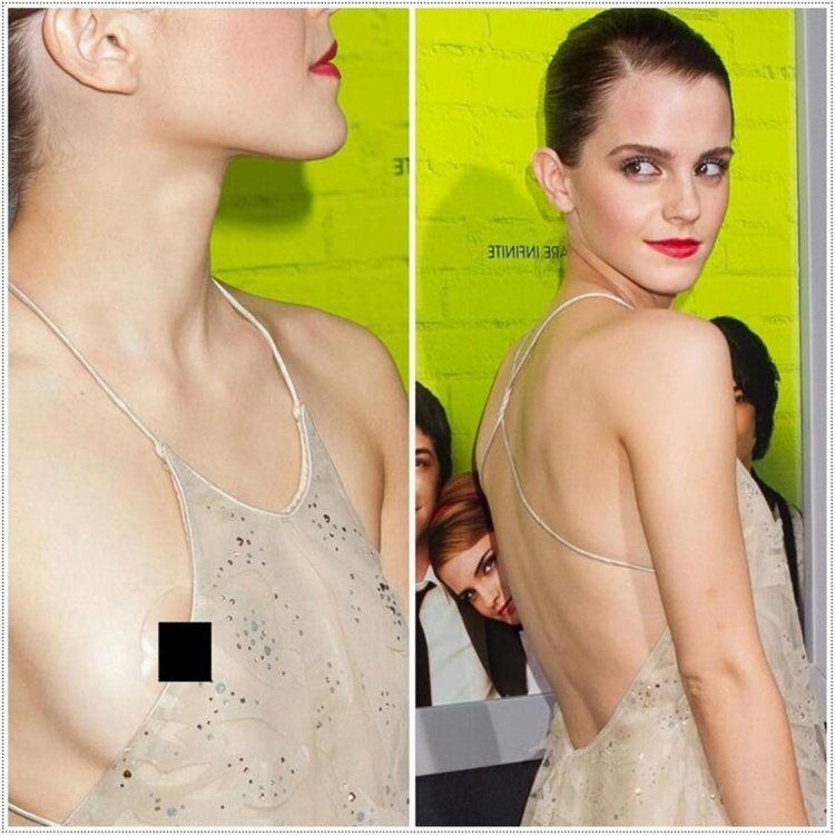 Emma Watson embarrassment