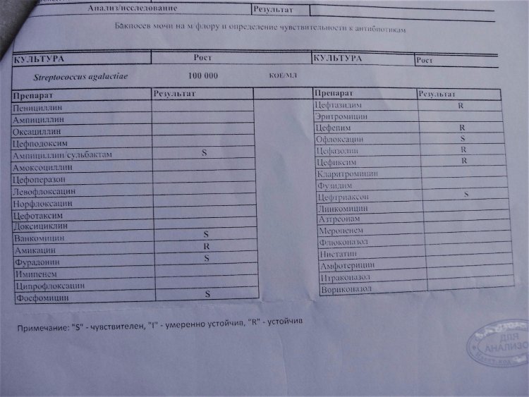 Red -haired girls amateur