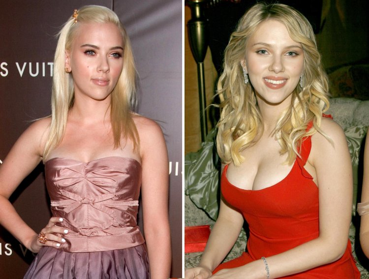 Scarlett Johansson to plastic