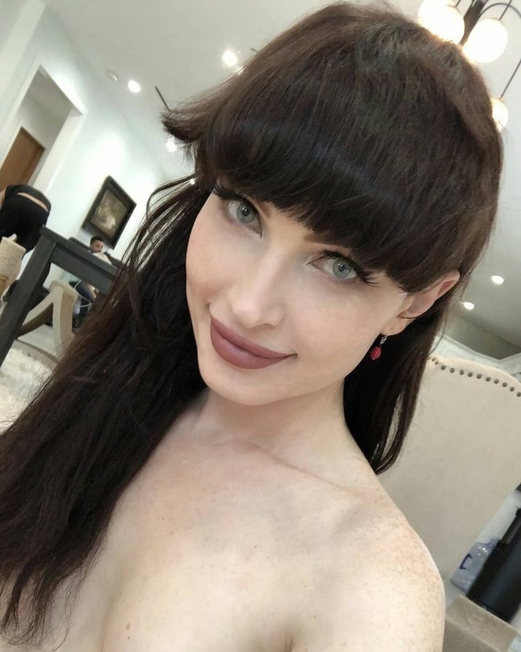 Natalie Mars Natalie Mars before surgery