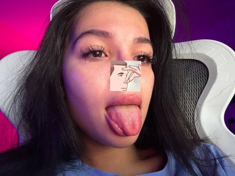 Amina's nose tenderlibai without a mask after surgery 2022