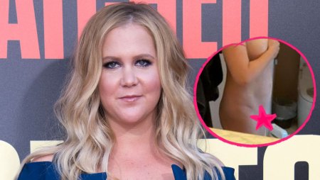 Amy Schumer hot