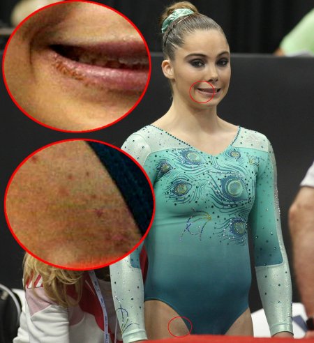 Maccail Maroni Bikini