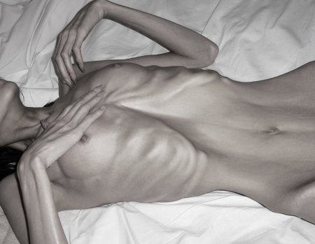 Naked thin anorexics