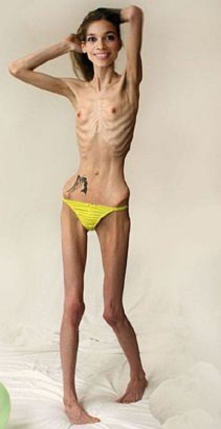 The crotch of anorexics