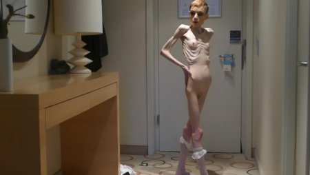 Porn actresses of anorexia