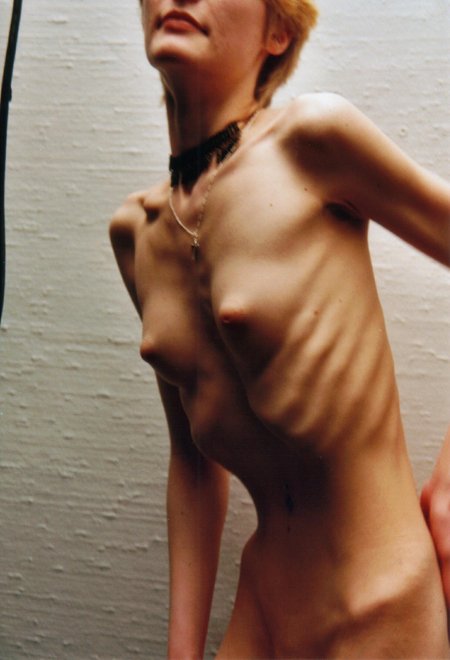 Beautiful naked anorexics