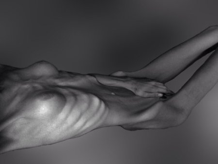 Naked anorexics models