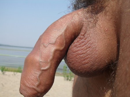 Naked disabled people.Cock and Balls