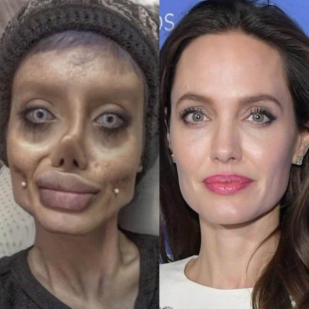 Angelina Jolie to plastic surgery