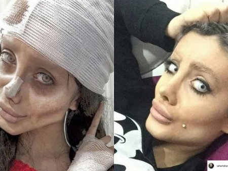 Sugar Tabar to plastic