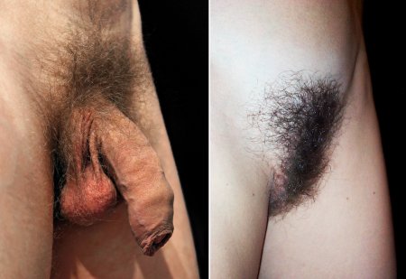 Pubic hair in men